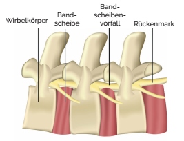 Foto: © Sbilderzwerg - Fotolia, Kernspinaufnahmen Foltin